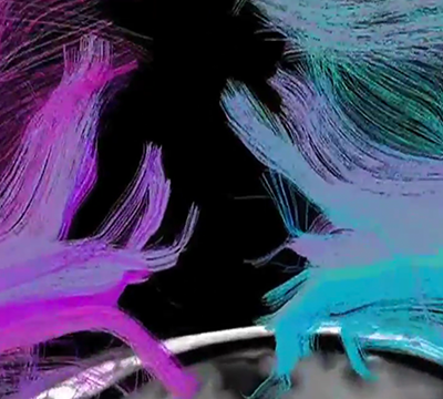 Brain Connectome: A beautiful ride