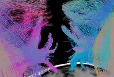 Brain Connectome: A beautiful ride