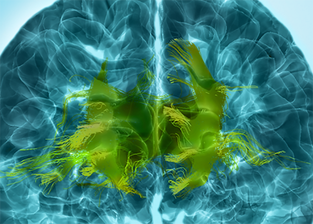 The aging brain