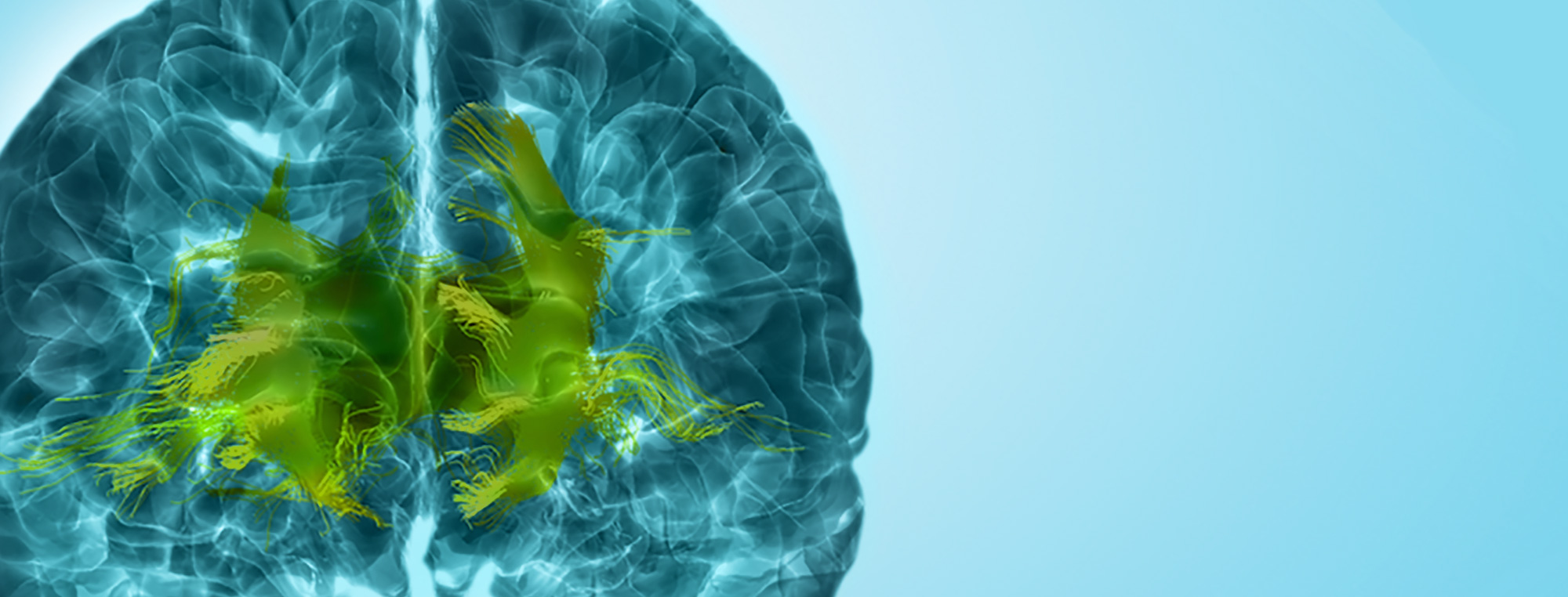 The aging brain