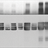Parkinson’s and proteins