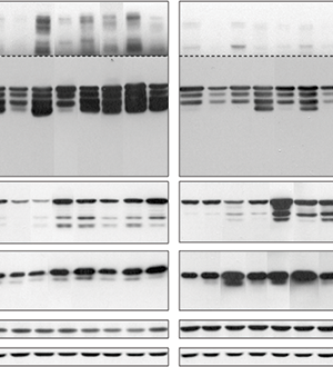 Parkinson’s and proteins