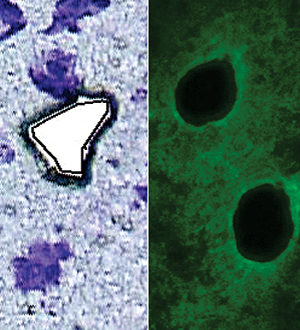 Stress and neurons