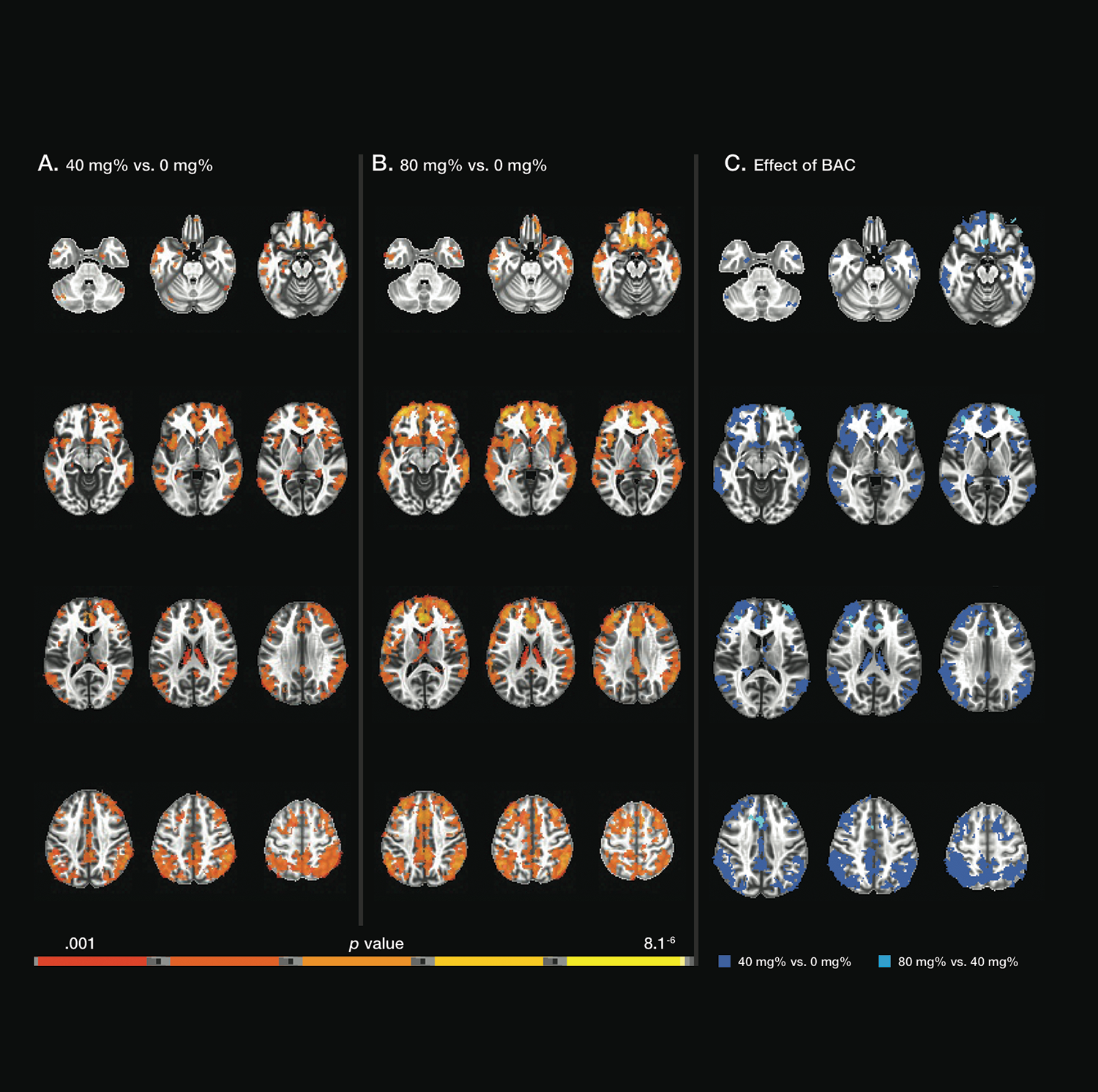 Alcohol on the brain
