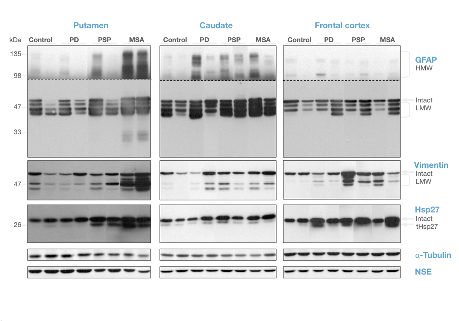 Parkinson’s and proteins