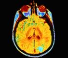 brain scan