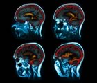 four brain scans