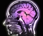 Cross section of head with brain